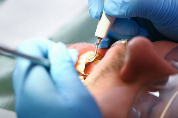 Best Weekend Emergency Dentist in Hennessey, OK