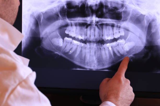 Best Emergency Tooth Extraction in Hennessey, OK